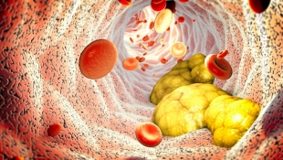 Биологи открыли бактерии, снижающие уровень холестерина в крови