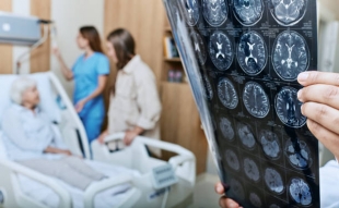 Ученые из США выяснили, что происходит с мозгом после инсульта