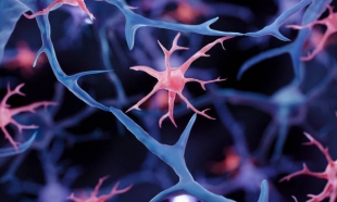 Связанный с болезнью Альцгеймера белок способствует отложению кальция в аорте