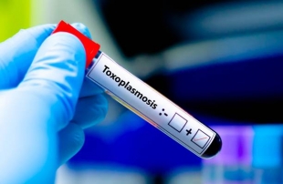 Исследование: паразит Toxoplasma gondii связан с риском развития шизофрении